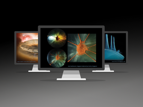 Imaging Module 910
